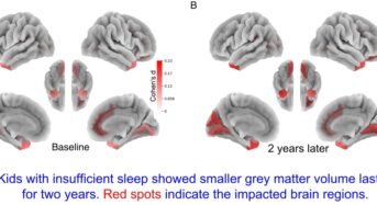 “초등생 수면부족, 뇌·인지 발달에 악영향”