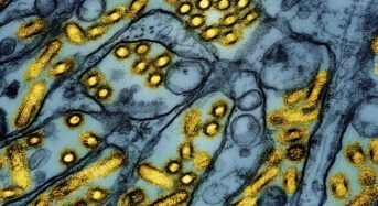 조류 인플루엔자 첫 사망…”65세 기저질환자”