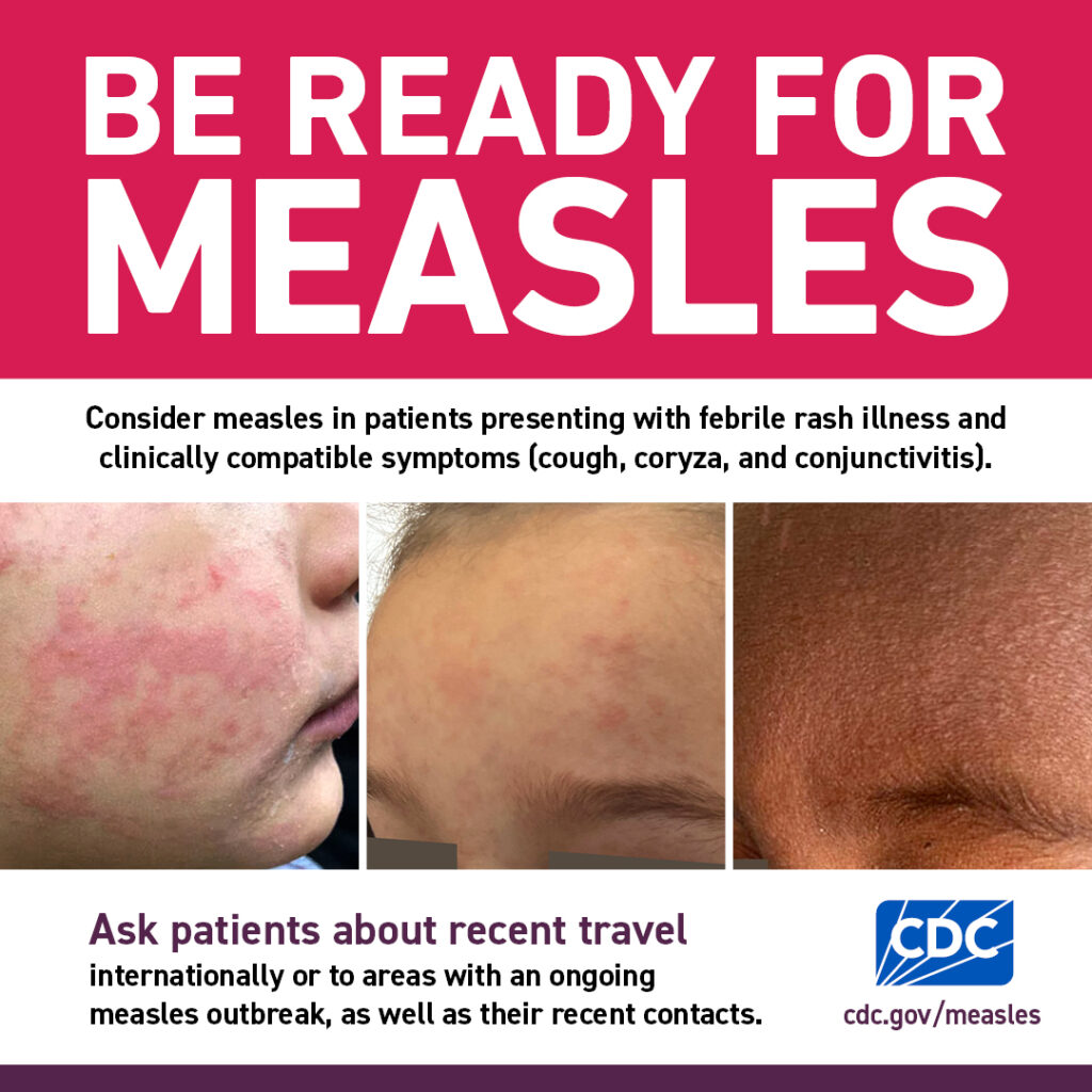 measles-be-ready-hcp-1080x1080
